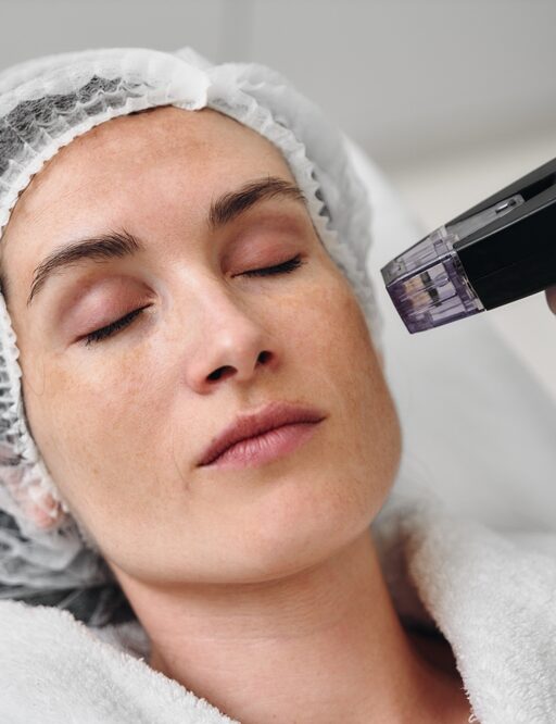 Microneedling 101: Everything You Need to Know About Collagen Induction Therapy